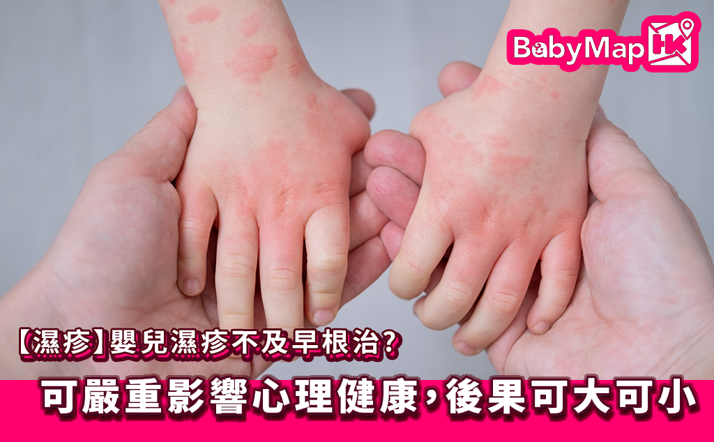 嬰兒濕疹不及早根治，可嚴重影響心理健康，後果可大可小